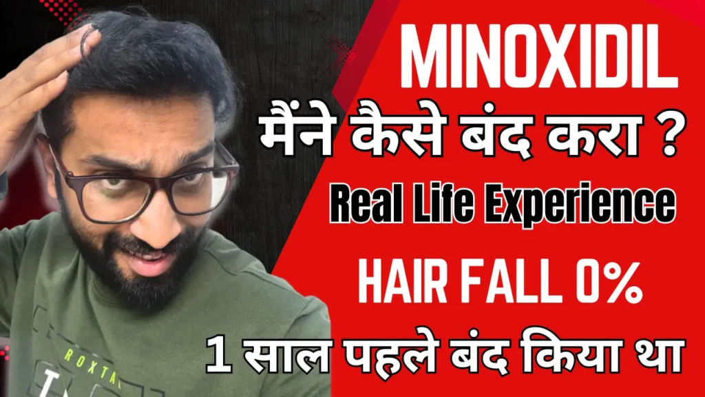 hair fall hona band ho gyaya minoxidil chodh kr