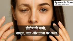 rotein deficiency effects on nails, hair, and skin illustration.